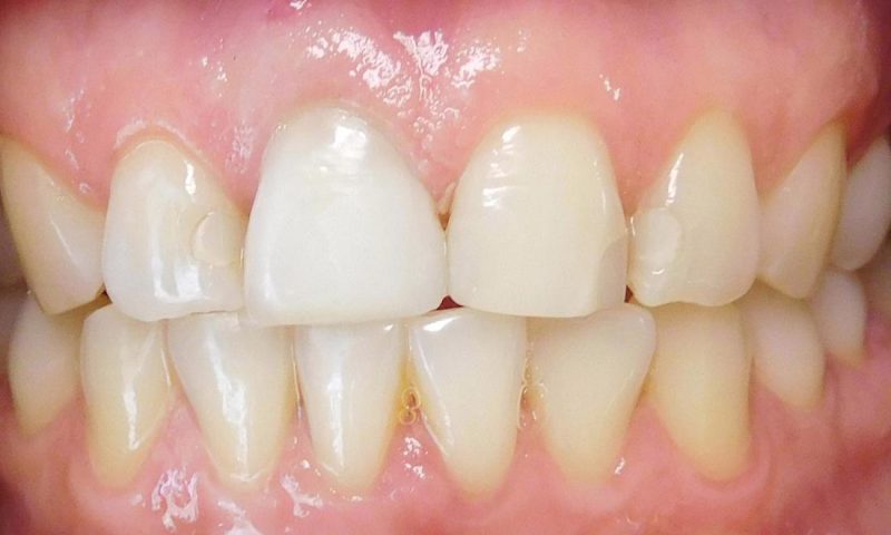 Gallery - Oak Family Dental